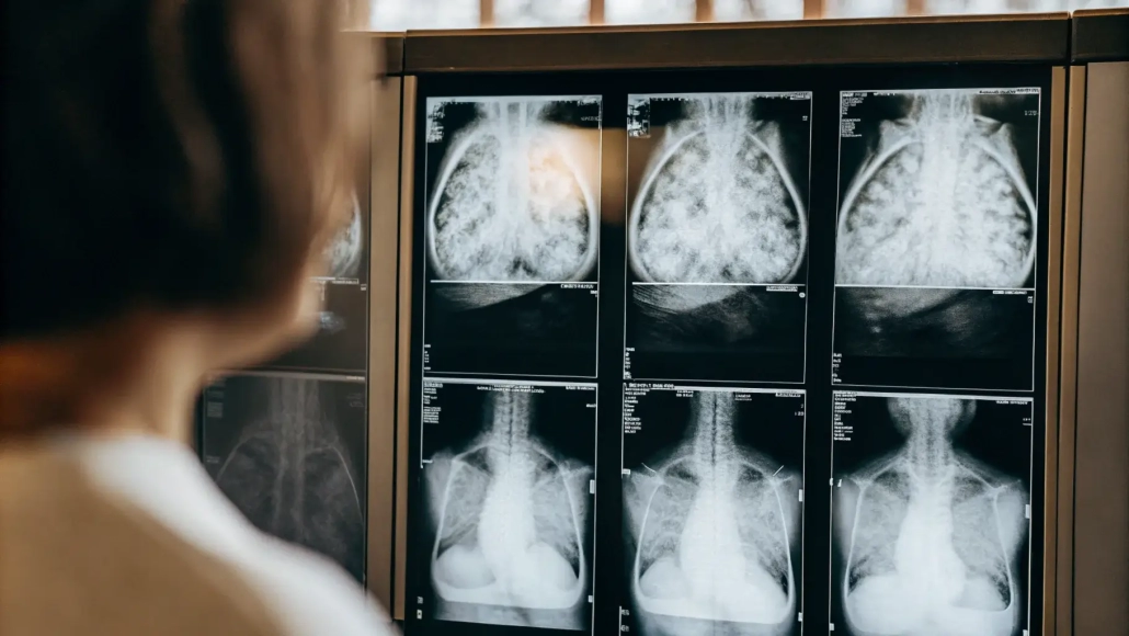 Behandlungsfehler bei Krebs