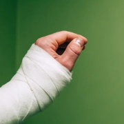 Morbus Sudeck nach Gipsverband Frankfurt
